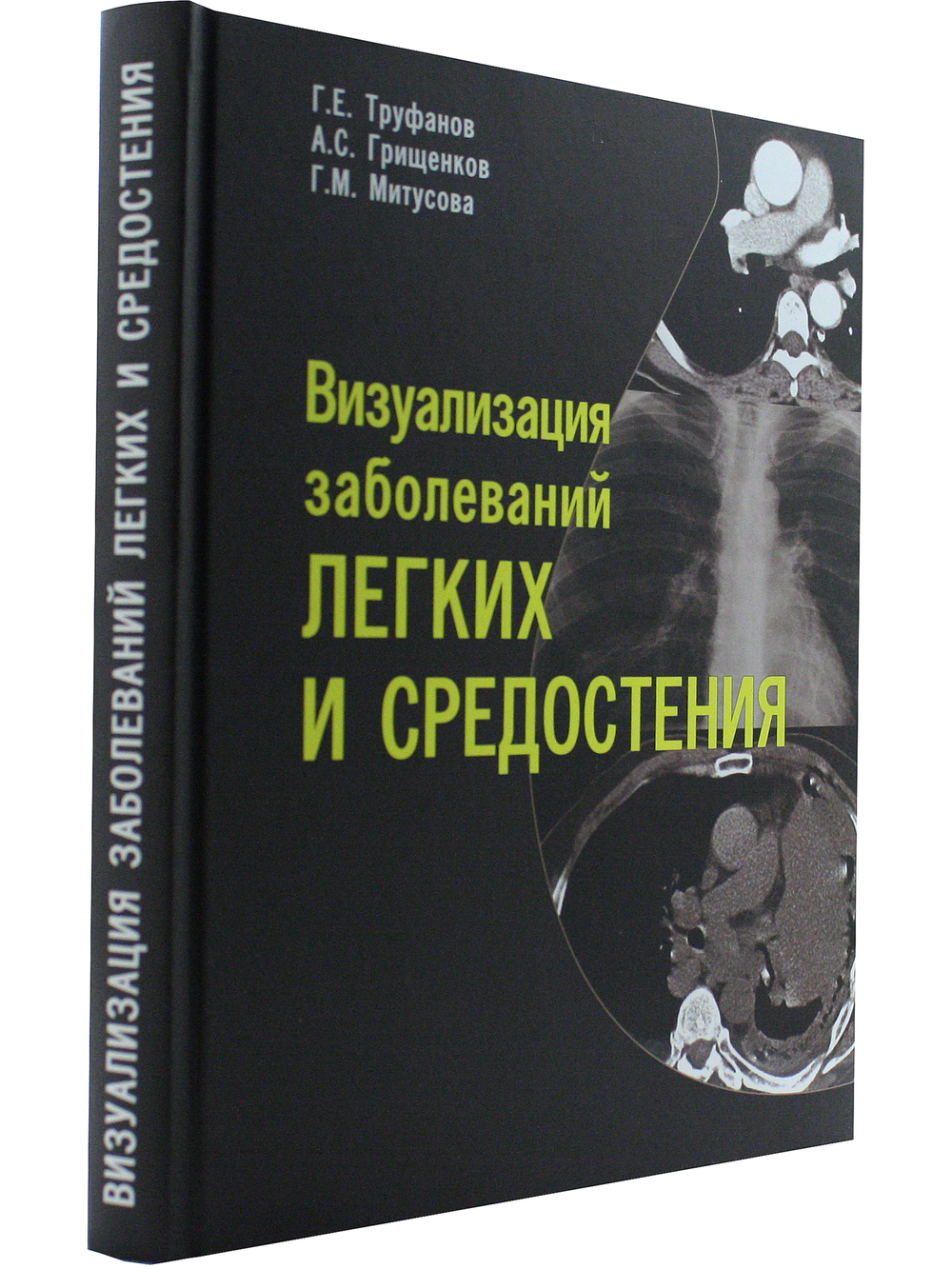 Визуализация заболеваний легких и средостения