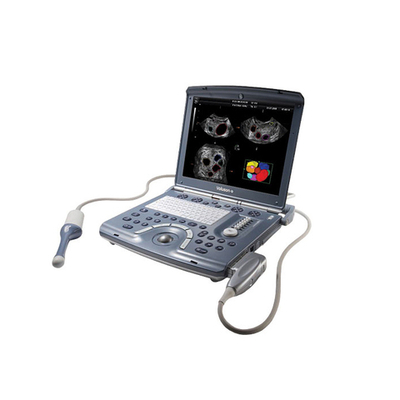 Портативный ультразвуковой аппарат GE Healthcare Voluson E