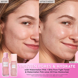 Glow Recipe Watermelon Glow PHA + BHA Pore-Tight Toner 150ml